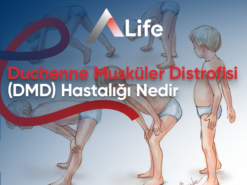 DMD (Duchenne Musküler Distrofisi) Hastalığı Nedir?
